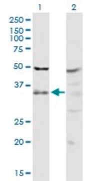 Anti-PIH1D1 antibody produced in rabbit purified immunoglobulin, buffered aqueous solution