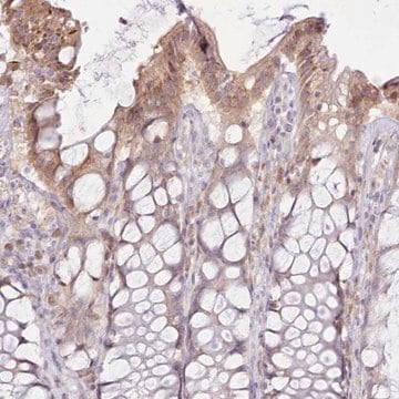 Anti-CCL1 antibody produced in rabbit Prestige Antibodies&#174; Powered by Atlas Antibodies, affinity isolated antibody, buffered aqueous glycerol solution