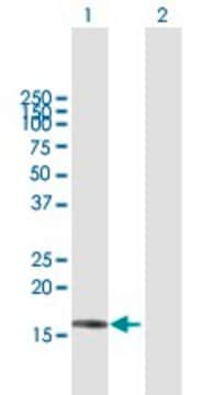 Anti-SRP19 antibody produced in mouse purified immunoglobulin, buffered aqueous solution