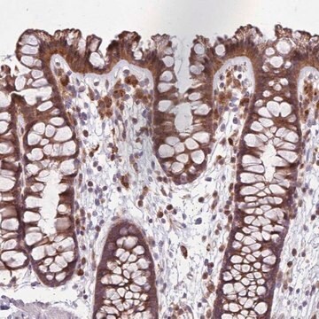 Anti-PPP1R27 antibody produced in rabbit Prestige Antibodies&#174; Powered by Atlas Antibodies, affinity isolated antibody, buffered aqueous glycerol solution