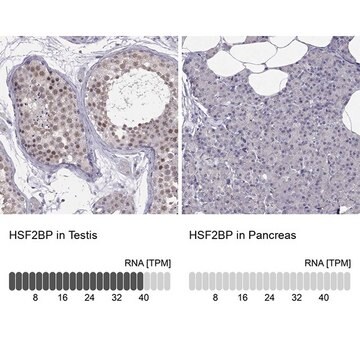 Anti-HSF2BP antibody produced in rabbit Prestige Antibodies&#174; Powered by Atlas Antibodies, affinity isolated antibody, buffered aqueous glycerol solution