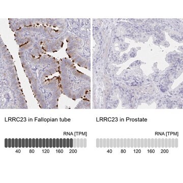 Anti-LRRC23 antibody produced in rabbit Prestige Antibodies&#174; Powered by Atlas Antibodies, affinity isolated antibody, buffered aqueous glycerol solution