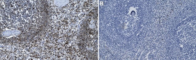 Anti-CD11a Antibody, clone 2J15 ZooMAb&#174; Rabbit Monoclonal recombinant, expressed in HEK 293 cells