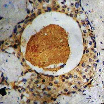 Anti-phospho-IL-7R/CD127 (pTyr449) antibody produced in rabbit affinity isolated antibody