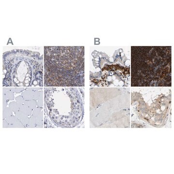 Anti-FNBP1 Prestige Antibodies&#174; Powered by Atlas Antibodies, affinity isolated antibody