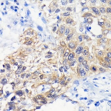 Anti-ATG3 antibody produced in rabbit