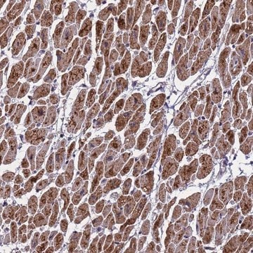 Anti-CMC4 antibody produced in rabbit Prestige Antibodies&#174; Powered by Atlas Antibodies, affinity isolated antibody, buffered aqueous glycerol solution