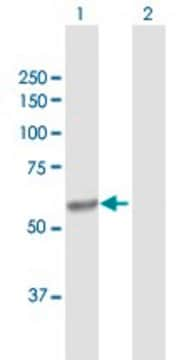 抗-CYP4V2 兔抗 purified immunoglobulin, buffered aqueous solution