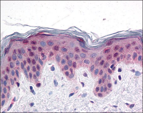 Anti-PRDM16 antibody produced in rabbit affinity isolated antibody