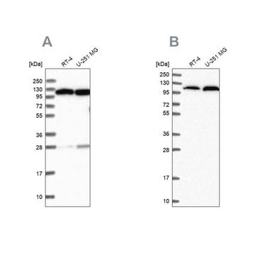 Anti-AARS antibody produced in rabbit Prestige Antibodies&#174; Powered by Atlas Antibodies, affinity isolated antibody, buffered aqueous glycerol solution