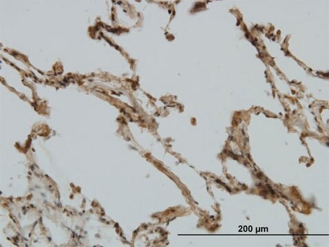 Monoclonal Anti-CRIM1 antibody produced in mouse clone 6E4, purified immunoglobulin, buffered aqueous solution