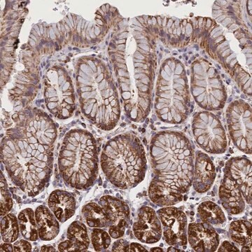 Anti-IFT122 antibody produced in rabbit Prestige Antibodies&#174; Powered by Atlas Antibodies, affinity isolated antibody, buffered aqueous glycerol solution