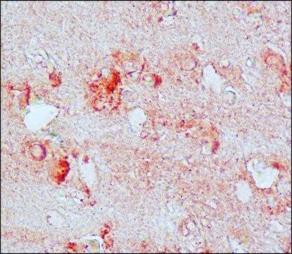 抗ニトロチロシン ウサギ宿主抗体 affinity isolated antibody, buffered aqueous solution