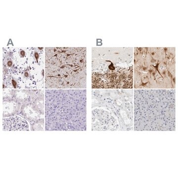 Anti-CCSAP antibody produced in rabbit Prestige Antibodies&#174; Powered by Atlas Antibodies, affinity isolated antibody, buffered aqueous glycerol solution