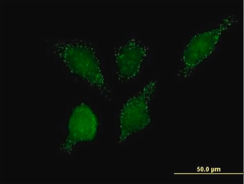 Anti-PHYH2 antibody produced in mouse IgG fraction of antiserum, buffered aqueous solution