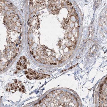 Anti-BEND4 antibody produced in rabbit Prestige Antibodies&#174; Powered by Atlas Antibodies, affinity isolated antibody, buffered aqueous glycerol solution