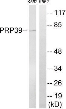 Anti-PRPF39 antibody produced in rabbit affinity isolated antibody