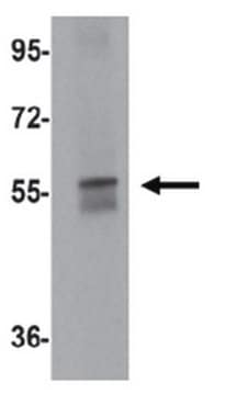 Anti-NETO1 Antibody from rabbit, purified by affinity chromatography