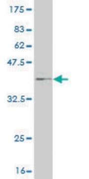 Monoclonal Anti-CPT2 antibody produced in mouse clone 1G7, purified immunoglobulin, buffered aqueous solution