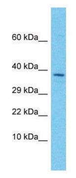 Anti-EGFLAM (C-terminal) antibody produced in rabbit affinity isolated antibody