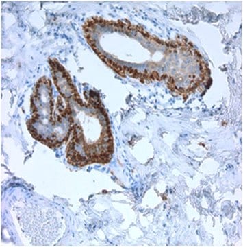 Anti-SERPINB5 Antibody, clone 5C6.2 clone 5C6.2, from mouse