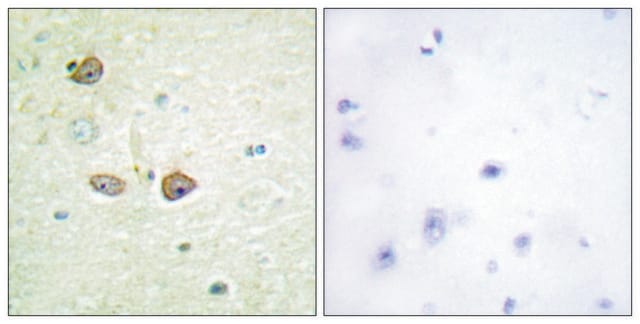 Anti-5-HT-1B antibody produced in rabbit affinity isolated antibody