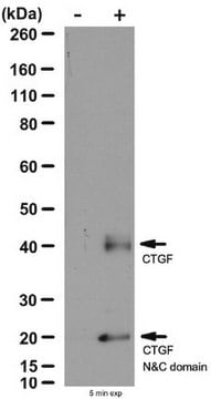 Anti-Connective Tissue Growth Factor Antibody from goat