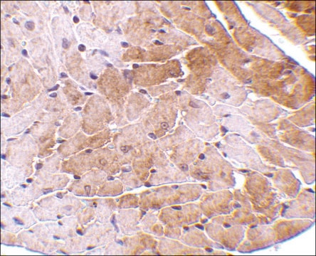 Anti-CIDE-A (ab1) antibody produced in rabbit affinity isolated antibody, buffered aqueous solution