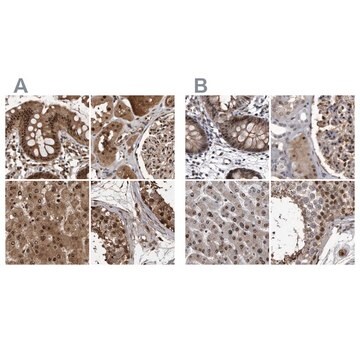 Anti-RAD23B antibody produced in rabbit Prestige Antibodies&#174; Powered by Atlas Antibodies, affinity isolated antibody, buffered aqueous glycerol solution, ab1