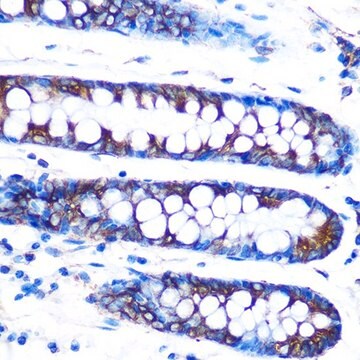 Anti-Lumican (LUM) antibody produced in rabbit