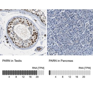 Anti-PARN antibody produced in rabbit Prestige Antibodies&#174; Powered by Atlas Antibodies, affinity isolated antibody, buffered aqueous glycerol solution