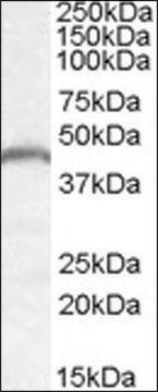 Anti-PNPLA3 antibody produced in goat affinity isolated antibody, buffered aqueous solution