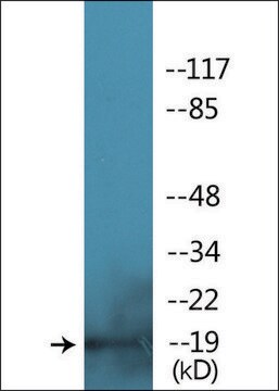 抗 磷酸-肌球蛋白调节轻链 2 (pSer 18 ) 兔抗 affinity isolated antibody