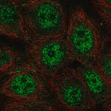 Anti-WDYHV1 antibody produced in rabbit Prestige Antibodies&#174; Powered by Atlas Antibodies, affinity isolated antibody