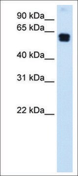 Anti-DOK1 antibody produced in rabbit affinity isolated antibody