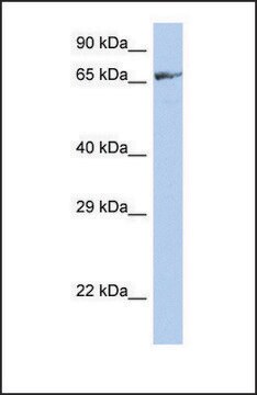 Anti-ZNF676 antibody produced in rabbit affinity isolated antibody