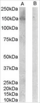 Anti-ERBB3/HER3 antibody produced in goat affinity isolated antibody, buffered aqueous solution