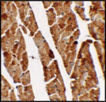 Anti-TGM5 antibody produced in rabbit affinity isolated antibody