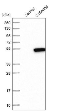 Anti-C16orf58 antibody produced in rabbit Prestige Antibodies&#174; Powered by Atlas Antibodies, affinity isolated antibody, buffered aqueous glycerol solution