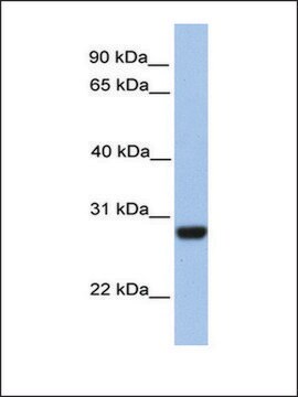 Anti-PAOX (AB2) antibody produced in rabbit affinity isolated antibody