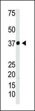 ANTI-IKB ALPHA (IKBA) antibody produced in rabbit IgG fraction of antiserum, buffered aqueous solution