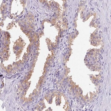 Anti-FAM177A1 antibody produced in rabbit Prestige Antibodies&#174; Powered by Atlas Antibodies, affinity isolated antibody, buffered aqueous glycerol solution