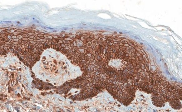 Anticorpo anti-CD44v6, esone v6, clone VFF-18 clone VFF-18, Chemicon&#174;, from mouse