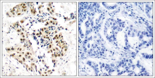 Anti-phospho-ATM (pSer1981) antibody produced in rabbit affinity isolated antibody