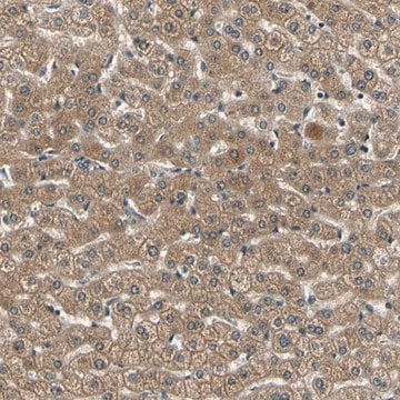 Anti-LPGAT1 antibody produced in rabbit Prestige Antibodies&#174; Powered by Atlas Antibodies, affinity isolated antibody, buffered aqueous glycerol solution