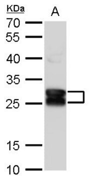 Anti-CRYBA1 antibody produced in rabbit affinity isolated antibody ...