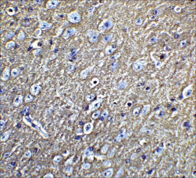 Anti-LMX1B antibody produced in rabbit affinity isolated antibody