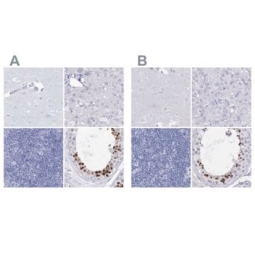 Anti-ACRV1 antibody produced in rabbit Prestige Antibodies&#174; Powered by Atlas Antibodies, affinity isolated antibody, buffered aqueous glycerol solution