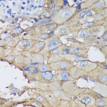 Anti-CEACAM5 antibody produced in mouse