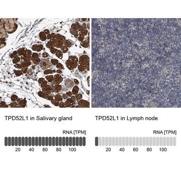 Anti-TPD52L1 antibody produced in rabbit Prestige Antibodies&#174; Powered by Atlas Antibodies, affinity isolated antibody, buffered aqueous glycerol solution, ab2